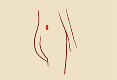 胎记长在腰上代表什么 胎记长在腰上有什么说法
