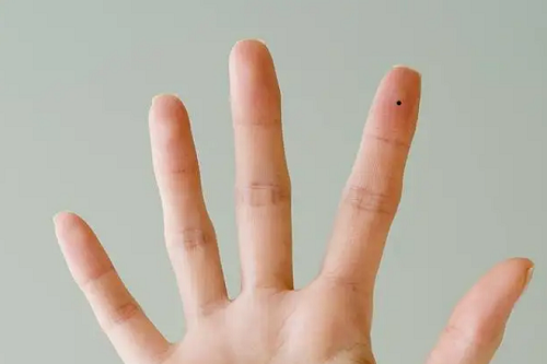 左手食指有痣的女人配偶 左手食指有痣的女人配偶如何