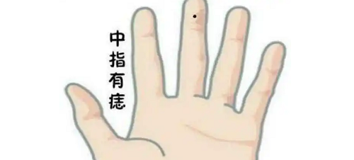 女人右手中指有痣好不好 女人右手中指有痣代表什么含义