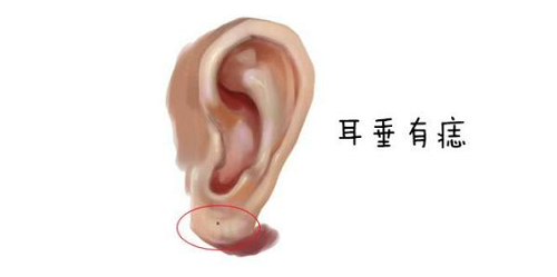 耳朵长痣的位置代表什么 耳朵长痣的位置代表什么意思